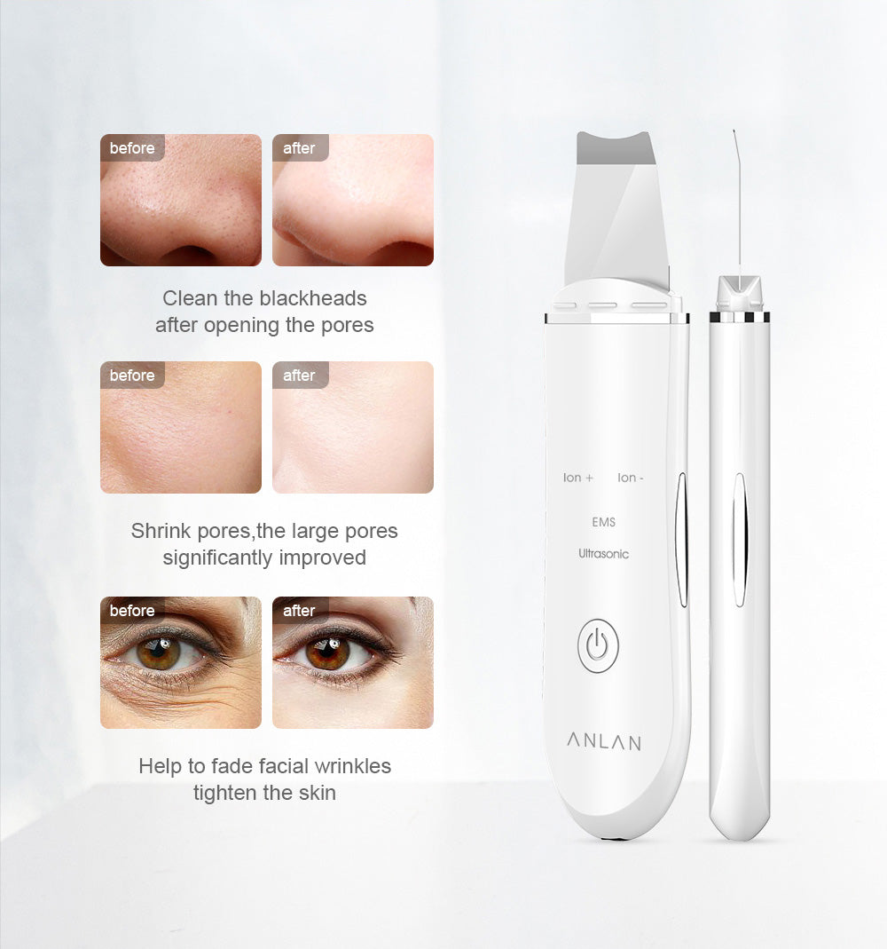 PureLift Pro™ — Ultrasonic Deep Cleansing & Skin Prep Device